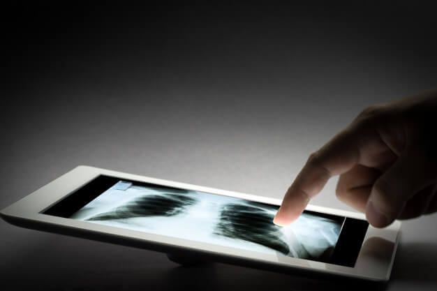 radiologia digital no tablet