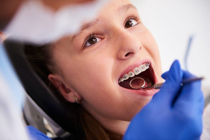 ortodontia crianca aparelho