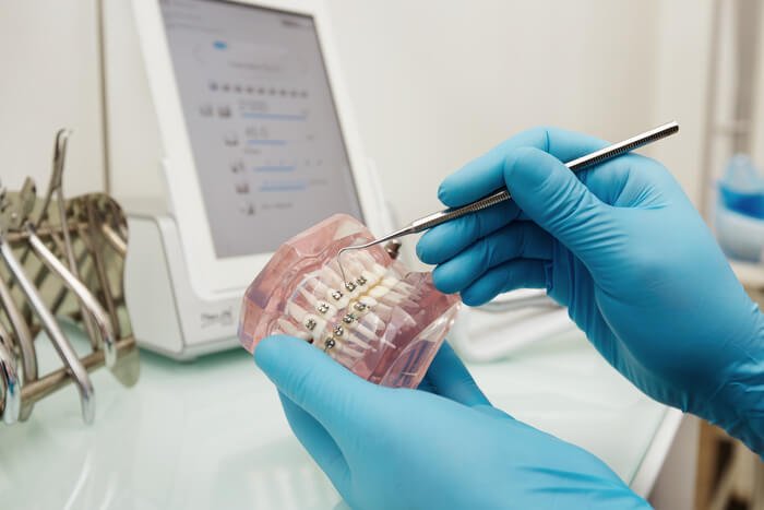 software odontologico computador dentista segurando molde